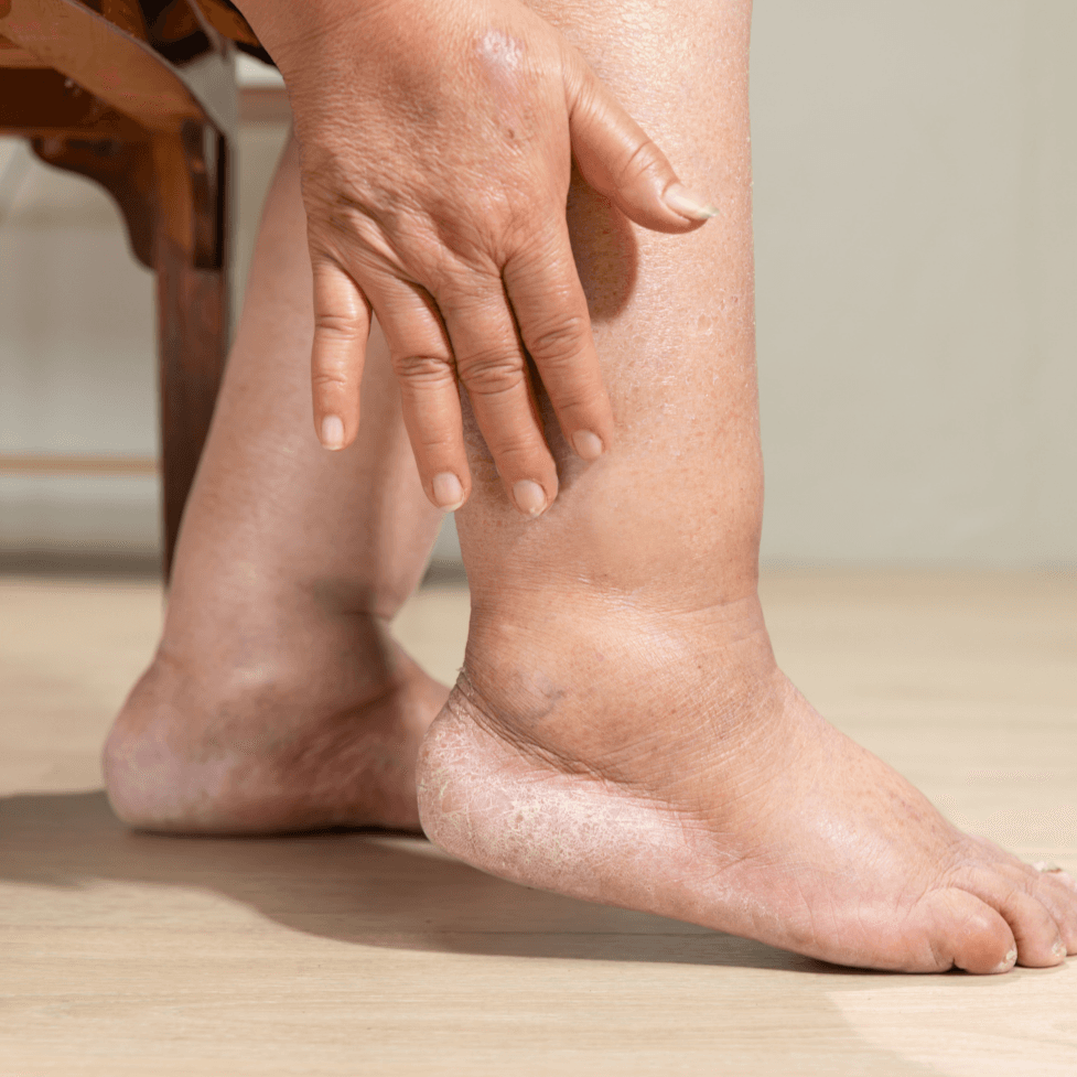 Numbness relief illustration